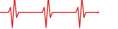electrocardiogram-5090352_640 electrocardiogram-5090352_640